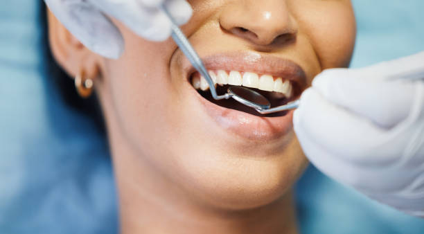 Best Emergency Dentist for Knocked-Out Tooth in Wentzville, MO