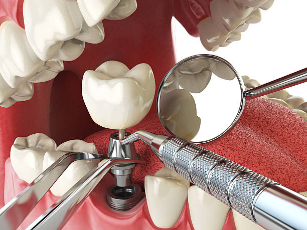Best Emergency Dental Services for Seniors in Wentzville, MO
